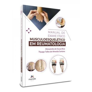 Imagem de Manual De Exame Físico Musculoesquelético Em Reumatologia