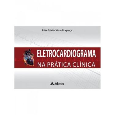 Imagem de Eletrocardiograma Na Pratica Clinica
