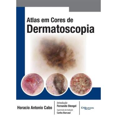 Imagem de Livro - Atlas Em Cores De Dermatoscopia - Cabo - Dilivros