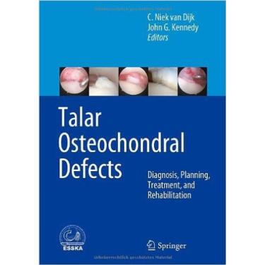 Imagem de Talar Osteochondral Defects