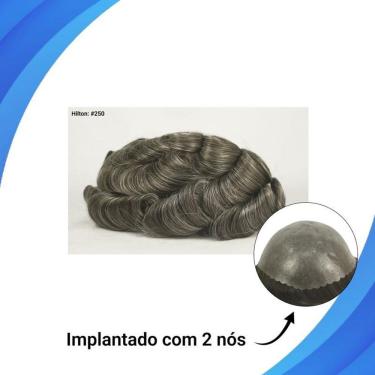 Imagem de Protese Capilar Micropele Hilton Tamanho 20X25 D=130%