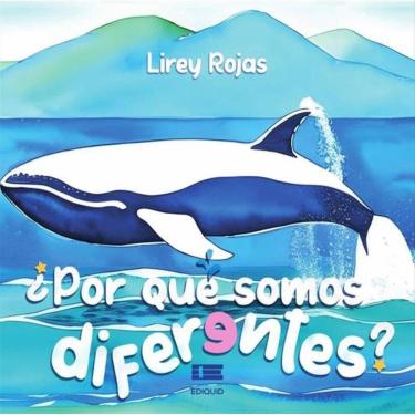 Imagem de ¿Por qué somos diferentes? - Espanhol