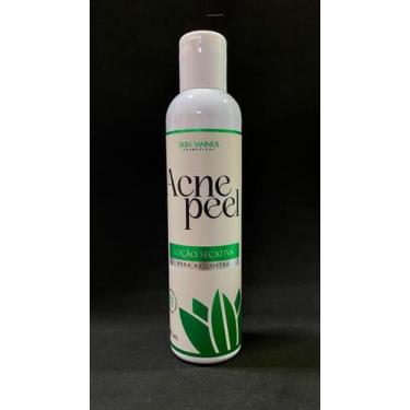Imagem de Acne Peel - 200ml - Skin Sannus