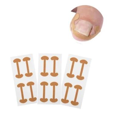 Imagem de Kit 12 Adesivos Corretores para Unha Encravada, Órtese Podológica, Tiras Impermeáveis e Respiráveis para Tratamento de Unhas dos Pés