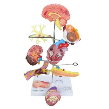 Imagem de Modelo de Órgãos Afetados pela Diabetes em 11 Partes SD-5213