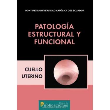 Imagem de Patología estructural y funcional. Cuello uterino - Espanhol