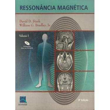 Imagem de Ressonancia Magnetica