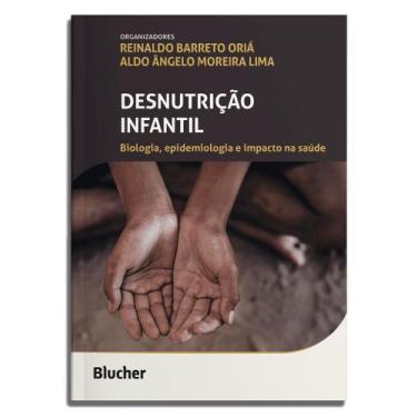 Imagem de Desnutrição Infantil - Biologia, Epidemiologia E Impacto Na Saúde - BL