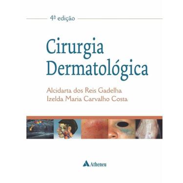 Imagem de Cirurgia Dermatológica