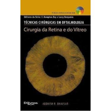 Imagem de Técnicas cirúrgicas em oftalmologia, Cirurgia da Retina e do Vítreo - 