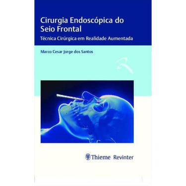 Imagem de Cirurgia Endoscopica Do Seio Frontal