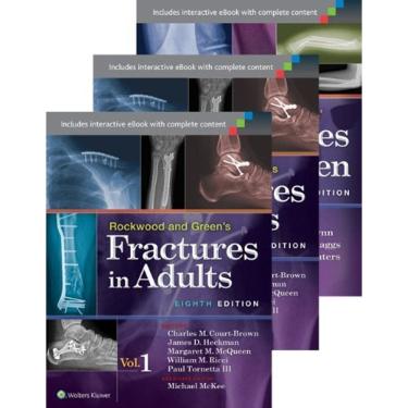 Imagem de Rockwood And Greens Fractures In Adults And Children (Package) 3 Vols.