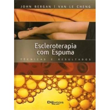 Imagem de Escleroterapia Com Espuma