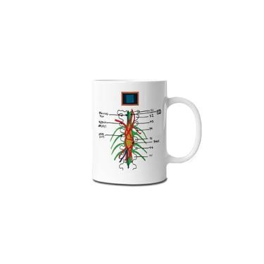 Imagem de Caneca Ceramica Tumor Inoperável Greys Anatomy