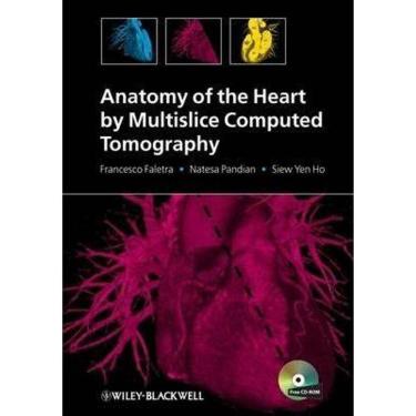 Imagem de Anatomy Of The Heart By Multislice Computed Tomography