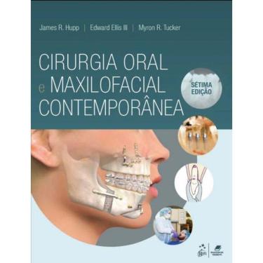Imagem de Cirurgia Oral e Maxilofacial Contemporânea - 07Ed/21