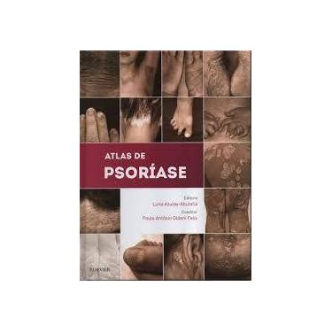 Imagem de ATLAS DE PSORÍASE Luna Azulay capa dura 