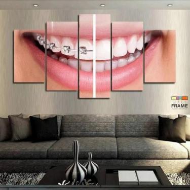 Imagem de Quadro Decorativo Dentista Aparelho 63x130mt com 5 peças - Wall Frame