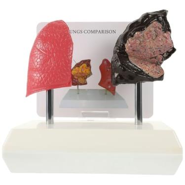 Imagem de Cabilock 1pc Lung Anatomical Model Smoking Lung Comparison for Medical Teaching and Education Realistic Pathological Features for Schools Laboratories Training