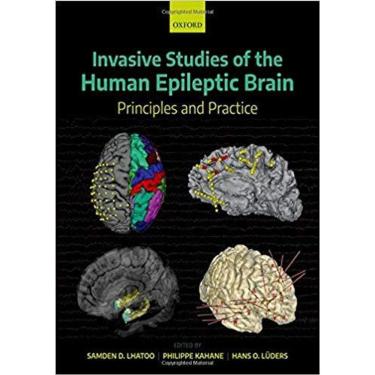 Imagem de Invasive Studies Of The Human Epileptic Brain
