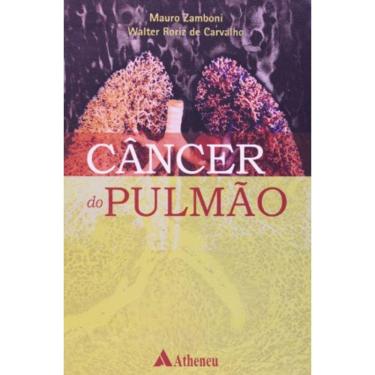 Imagem de Cancer Do Pulmao