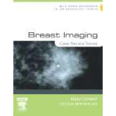 Imagem de Breast Imaging: Case Review - Elsevier Ed