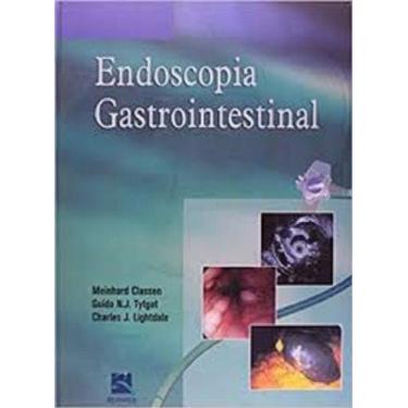 Imagem de Endoscopia gastrointestinal - REVINTER RJ