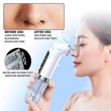Imagem de Limpadores faciais vibração espátula facial esfregador facial pá cavit