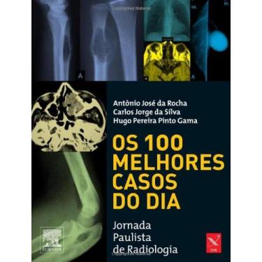 Imagem de Livro - Os 100 melhores casos do dia