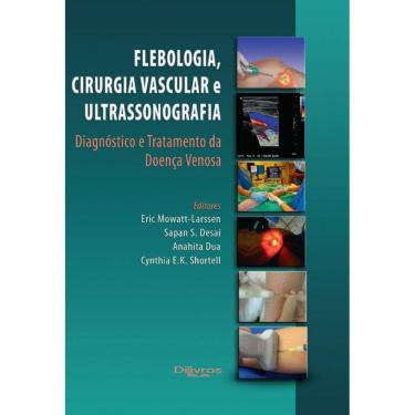 Imagem de Flebologia Cirurgia Vascular E Ultrassonografia  Diagnostico E Tratamento