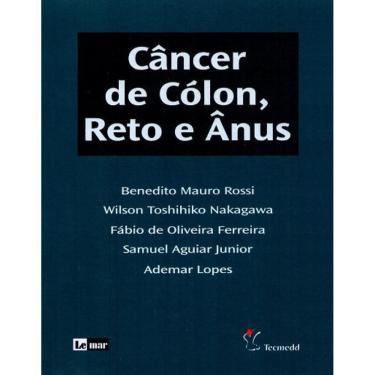 Imagem de Livro Câncer Do Cólon, Reto E Ânus