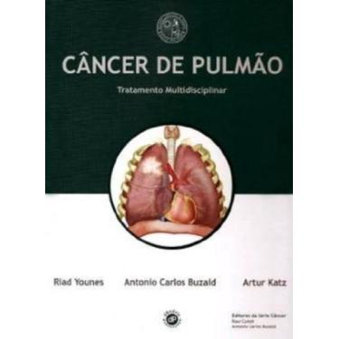 Imagem de Cancer de Pulmao Tratamento Multidisciplinar - Dendrix