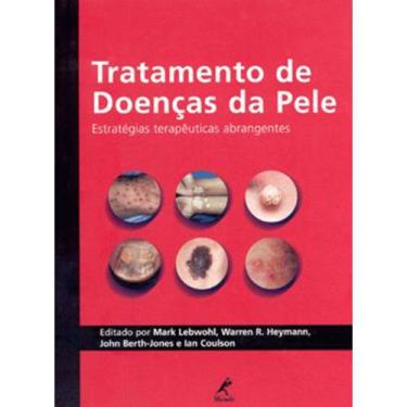 Imagem de Livro - Tratamento de doenças da pele