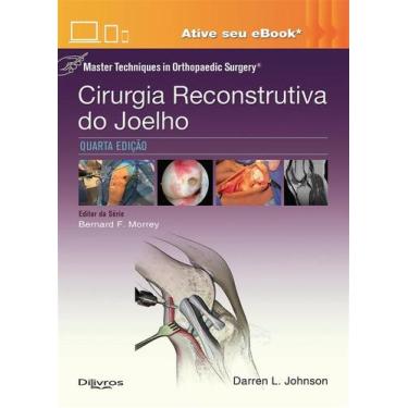 Imagem de Cirurgia reconstrutiva do joelho master techniques in orthopaedic surg