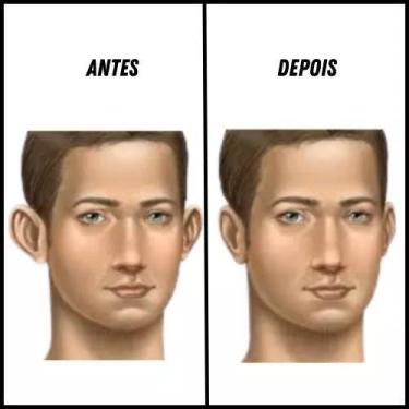 Imagem de Faixa Compressão Pós Otoplastia Estabilização Das Orelhas - Fanáticos 