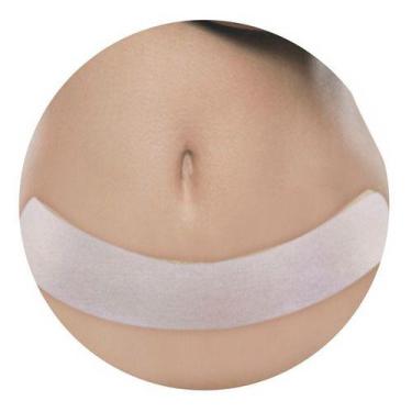 Imagem de Placa Evita Queloide Abdomen Cicatriz Cesaria Pos Cirugica - ORTHO PAU