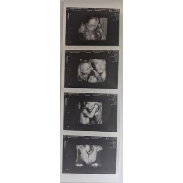 Imagem de Faixa de Ultrassom 3D Falsa para Brincadeira  4 Fotos Personalizadas -