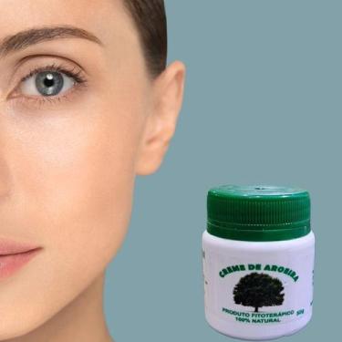 Imagem de Pomada Creme Auxiliar para Pele com Acne e Manchas Aroeira 50g - Creme