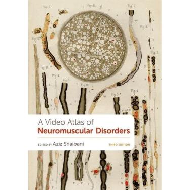 Imagem de A Video Atlas Of Neuromuscular Disorders