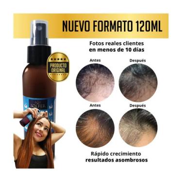 Imagem de Spray de crescimento capilar genérico rápido e eficaz 120 ml - Lightbe