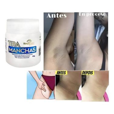 Imagem de Creme Removedor Clareador De Manchas Virilha Rosto Axilas 50g - NatyFl