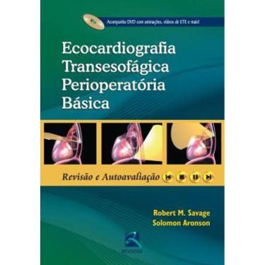 Imagem de Ecocardiografia Transesofagica Perioperatoria Basica