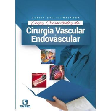 Imagem de Casos comentados de cirurgia vascular e endovascular - RUBIO, 3