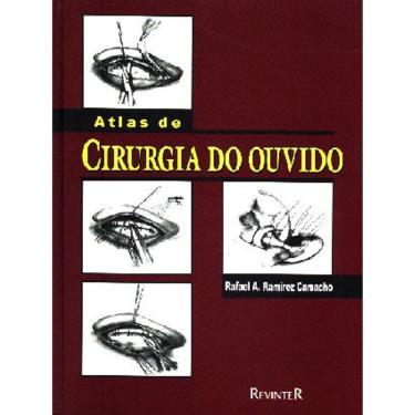 Imagem de Atlas de Cirurgia do Ouvido