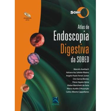 Imagem de Livro - Atlas de Endoscopia Digestiva da SOBED