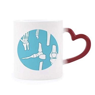 Imagem de Ilustrações de osso humano azul desenho desenho sensível ao calor caneca vermelha muda de cor grés copo