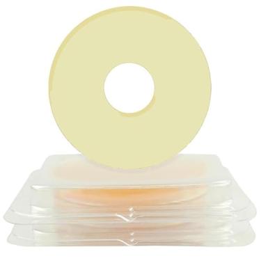 Imagem de 20 peças de anéis de barreira de ostomia de 2 mm, suprimentos de ostomia moldáveis, suprimentos de bolsa de ostomia hidrocolóide de grau médico flexível, espessura de 2 mm