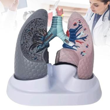 Imagem de Modelo de anatomia pulmonar humano, pulmão fumante e pulmão saudável, modelo de órgão do sistema respiratório humano como adereços de ensino