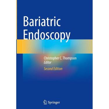 Imagem de Bariatric Endoscopy