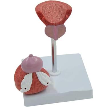 Imagem de Modelo de órgão humano, modelo anatômico masculino de próstata masculina, modelo de ensino de órgãos do sistema urinário, modelo de bexiga para exibição médica, auxílio de treinamento educacional.